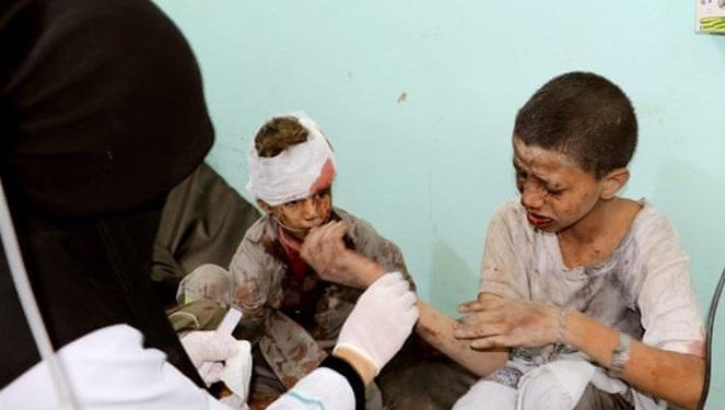 کشته و زخمی شدن چند کودک یمنی در شلیک خمپاره ای عناصر ائتلاف سعودی