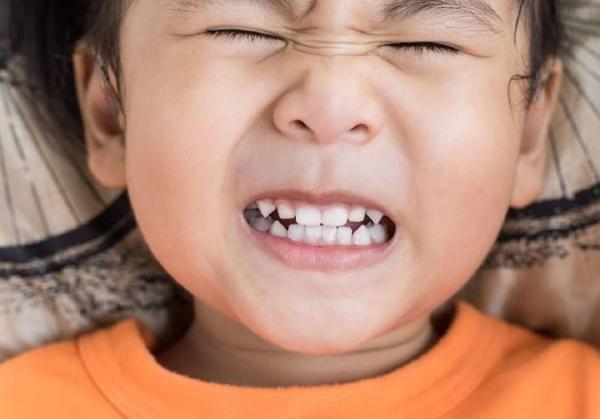 علت دندان قروچه در بچه ها و نحوه درمان آن